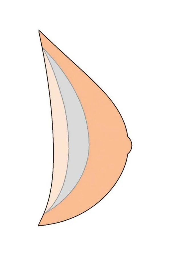 Amoena Natura Cosmetic 3E 322 Breast Form